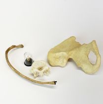 A collection of real human bones including a tooth in a dome, half pelvis, a rib and a vertebrae