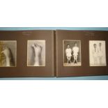 A Biological Photographic Association album of Diseases of Childhood, 1929-35, eighty photographs of