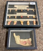 A presentation cased wax Model of "Morbi Dentium" showing teeth profile with printed notes, together