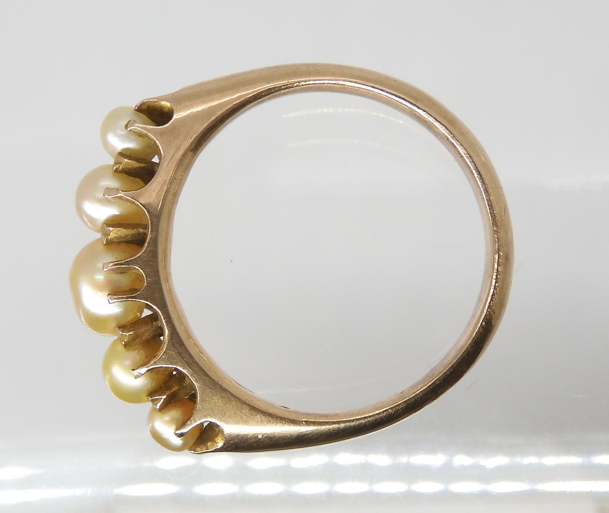 A VINTAGE PEARL RING set with five freeform cream pearls with good lustre, in a yellow metal - Image 4 of 5