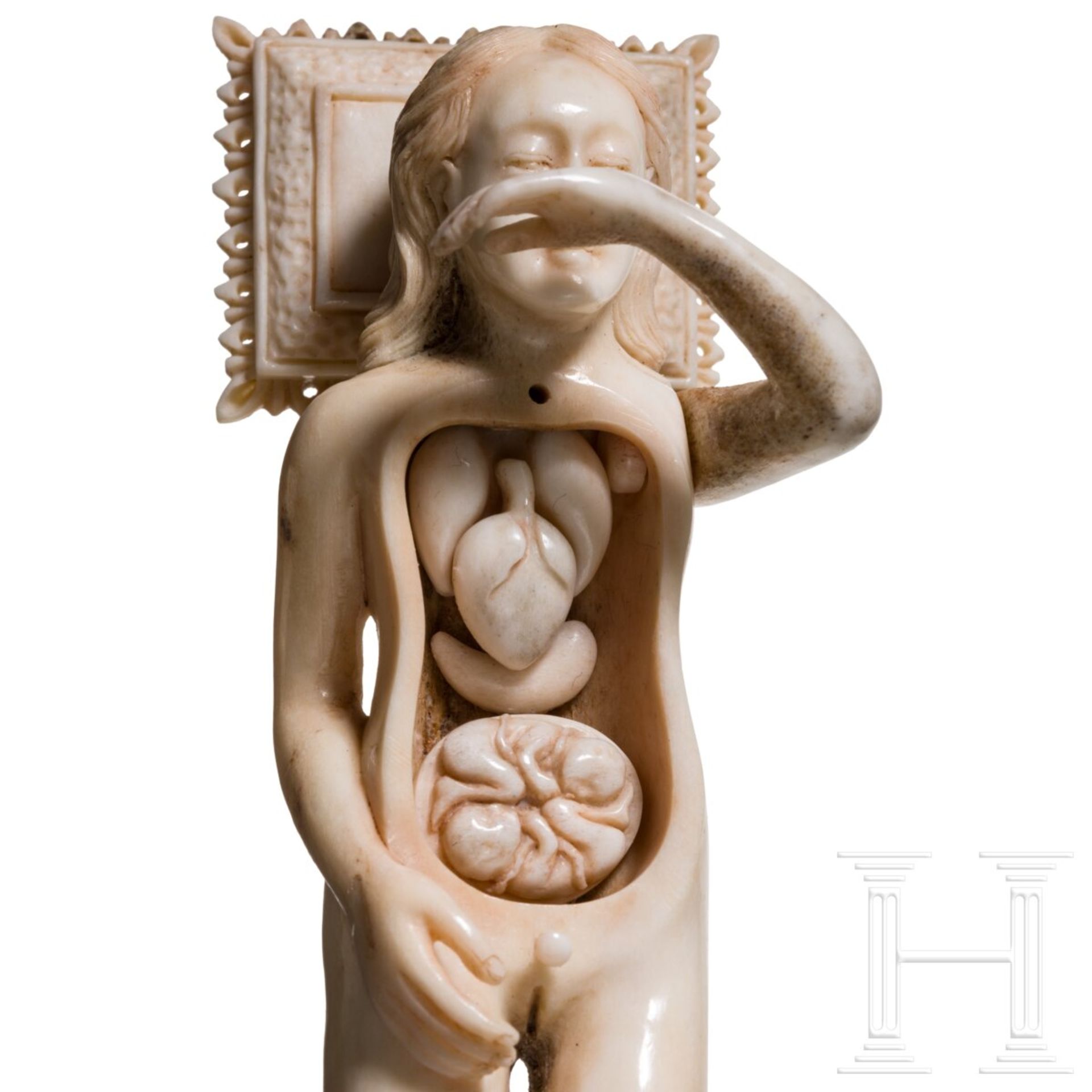 Anatomisches Modell (Doctor's Lady) im Stil des 17. Jhdts., wohl Goa, 19. Jhdt. - Image 3 of 5
