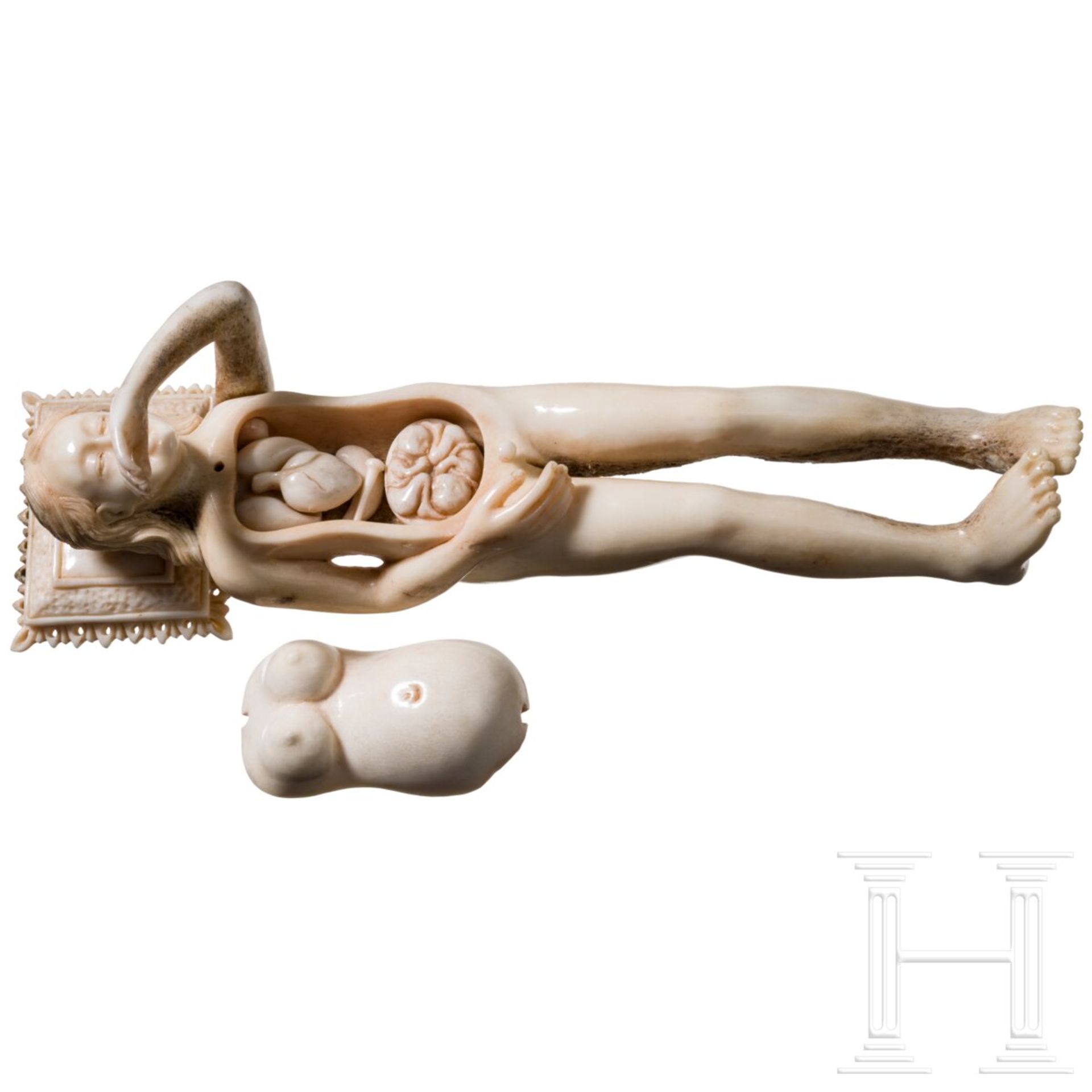 Anatomisches Modell (Doctor's Lady) im Stil des 17. Jhdts., wohl Goa, 19. Jhdt. - Image 2 of 5