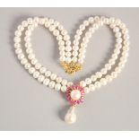 A PEARL NECKLACE with gold plated ruby and Baroque pearl clasp.