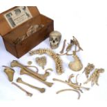 A Millikin and Lawley human skeleton in a pine box with original label, box 56cm wide