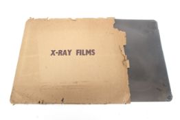 A collection of vintage x-ray film. Including examples of an unborn child, a skull, hands and more.