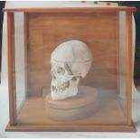 A 19thC medical human skull in glazed wooden case.