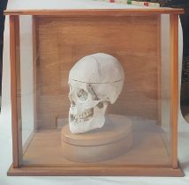 A 19thC medical human skull in glazed wooden case.