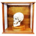 A mixed wood glazed display case containing a medical teaching aid human skull, set on wooden