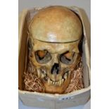 A HUMAN SKULL FOR MEDICAL / ACADEMIC PURPOSES, in two sections, springs to jaw / sides of skull,