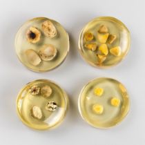 A VICTORIAN MEDICAL TEACHING AID COLLECTION OF GALLSTONES, LATER ENCASED IN GLAZED CIRCULAR