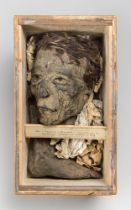 A RARE ANCIENT EGYPTIAN MUMMY HEAD. An extremely rare and fine mummified head and foot within a