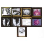 A large collection of medical glass slides,