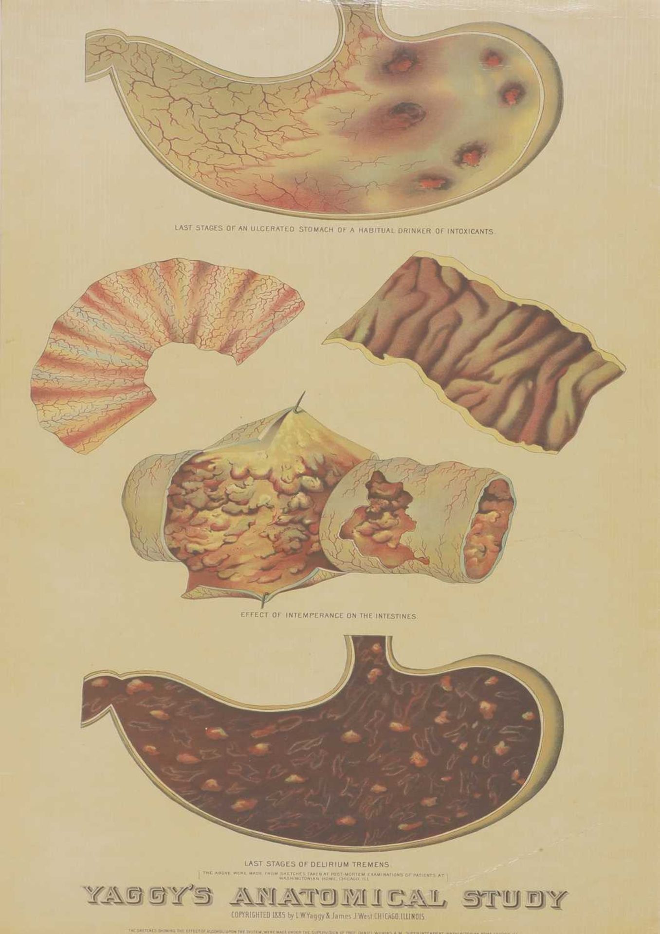 An anatomical classroom chart,