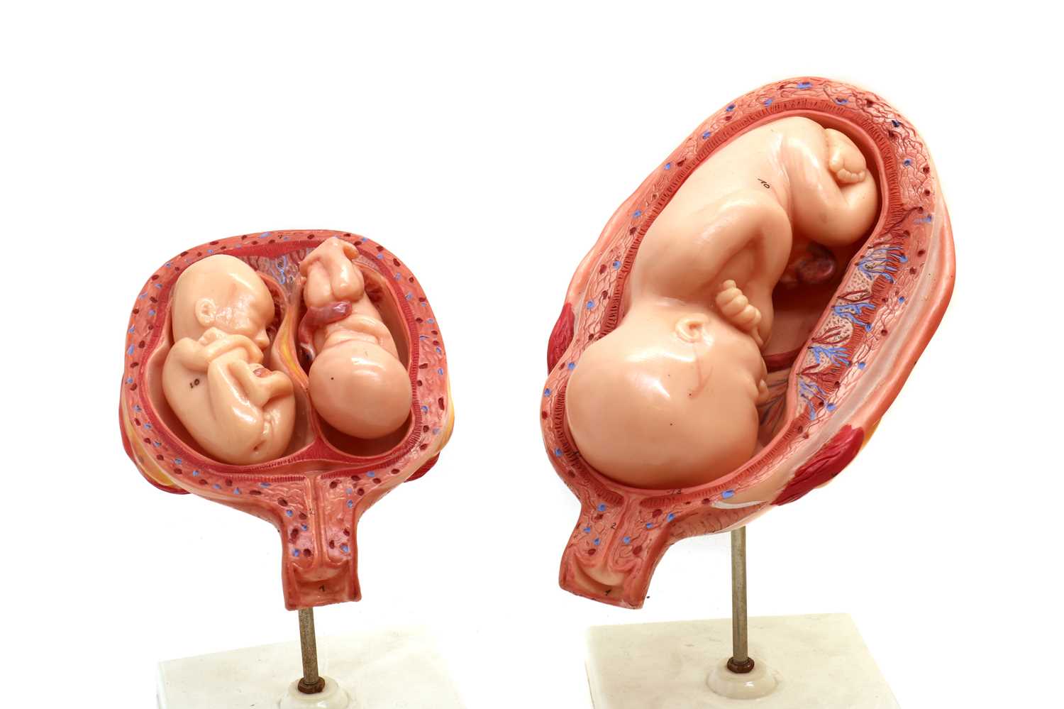 A West German plastic scientific model of a baby in a womb, - Image 6 of 6