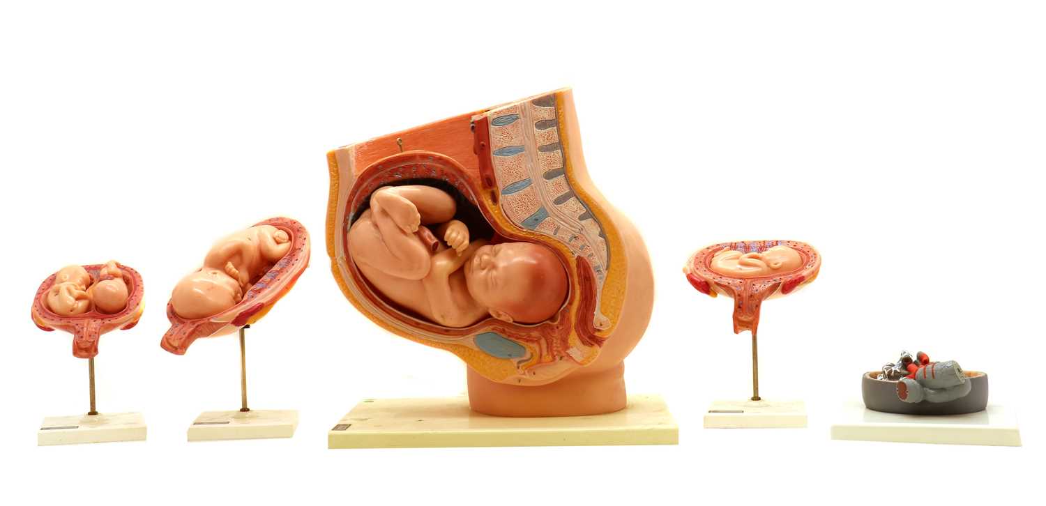 A West German plastic scientific model of a baby in a womb,