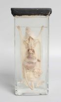 Natural History: A Preserved Wet Specimen of an Albino Common Rat (Rattus norvegicus), with internal