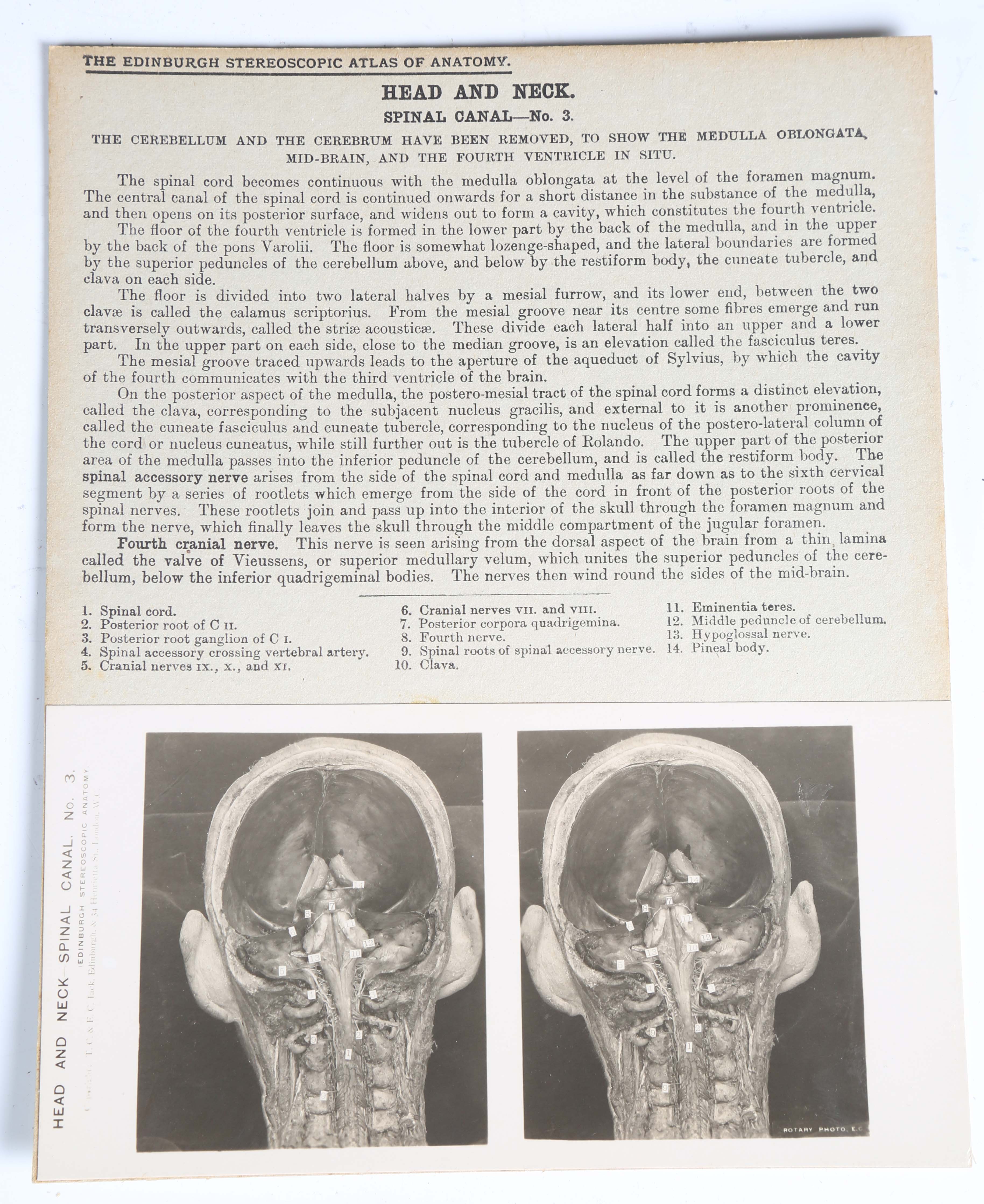 'The Edinburgh Stereoscopic Atlas of Anatomy', Waterston and Burnet, New Edition, Section IV, with a - Image 7 of 11