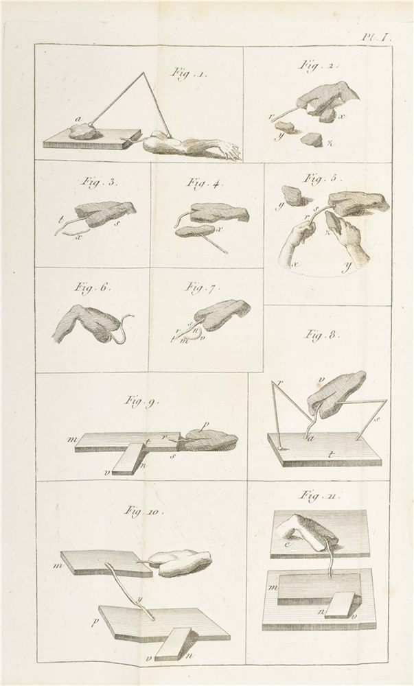 A. von Humboldt. Expériences sur le galvanisme - Image 3 of 7
