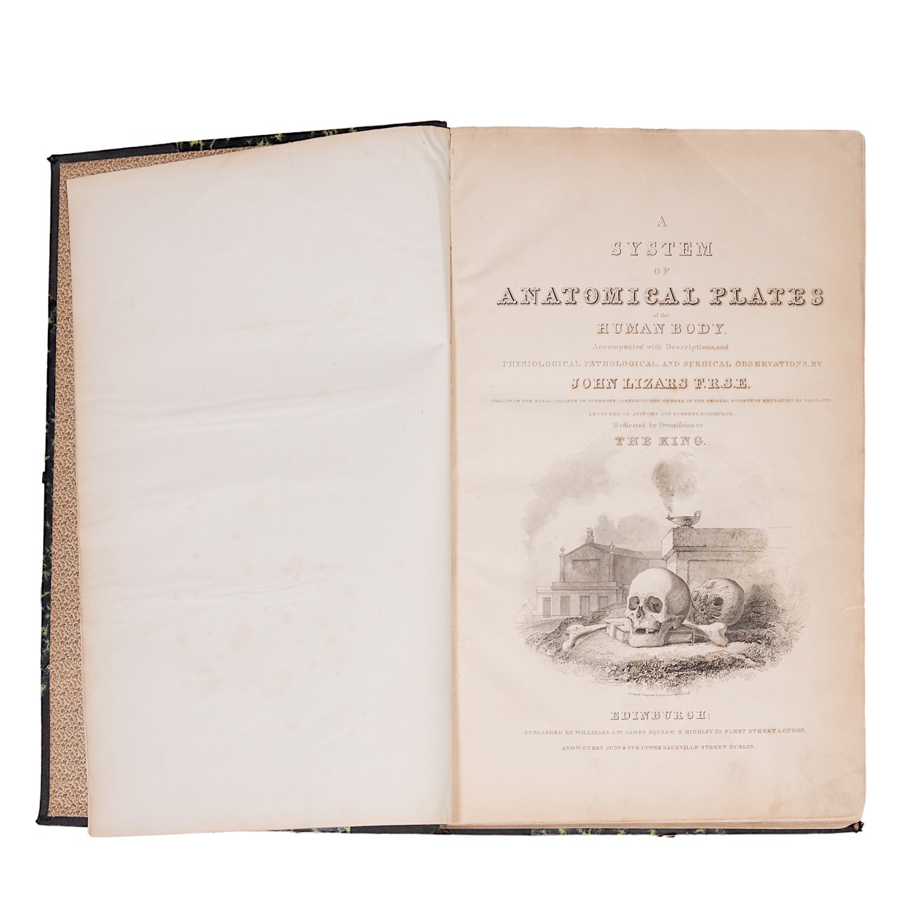John Lizars (ca. 1792-1860), a System of Anatomical Plates of the Human Body. Edinburgh: W.H. Lizars
