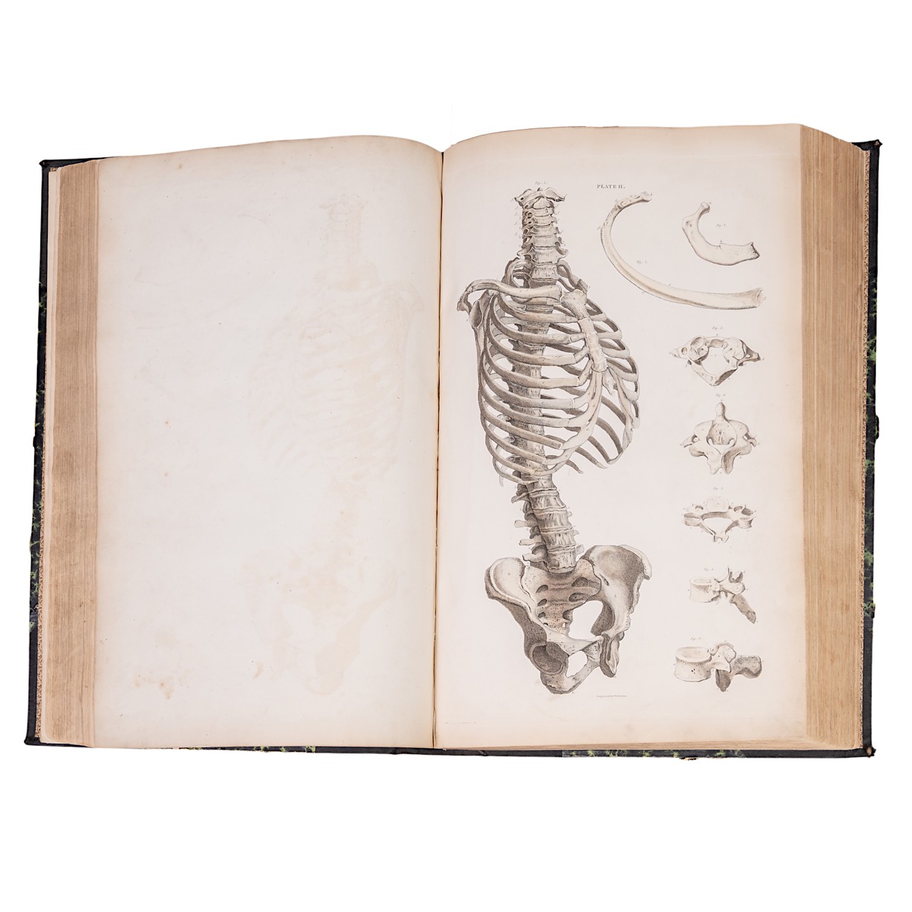 John Lizars (ca. 1792-1860), a System of Anatomical Plates of the Human Body. Edinburgh: W.H. Lizars - Image 3 of 7