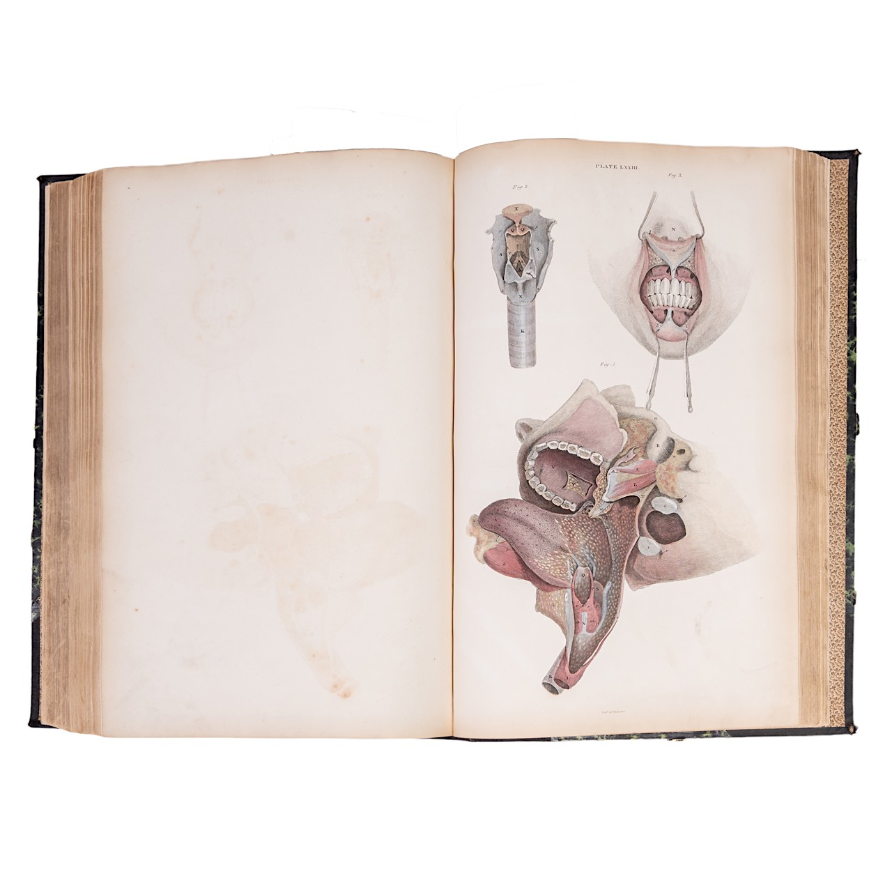 John Lizars (ca. 1792-1860), a System of Anatomical Plates of the Human Body. Edinburgh: W.H. Lizars - Bild 6 aus 7