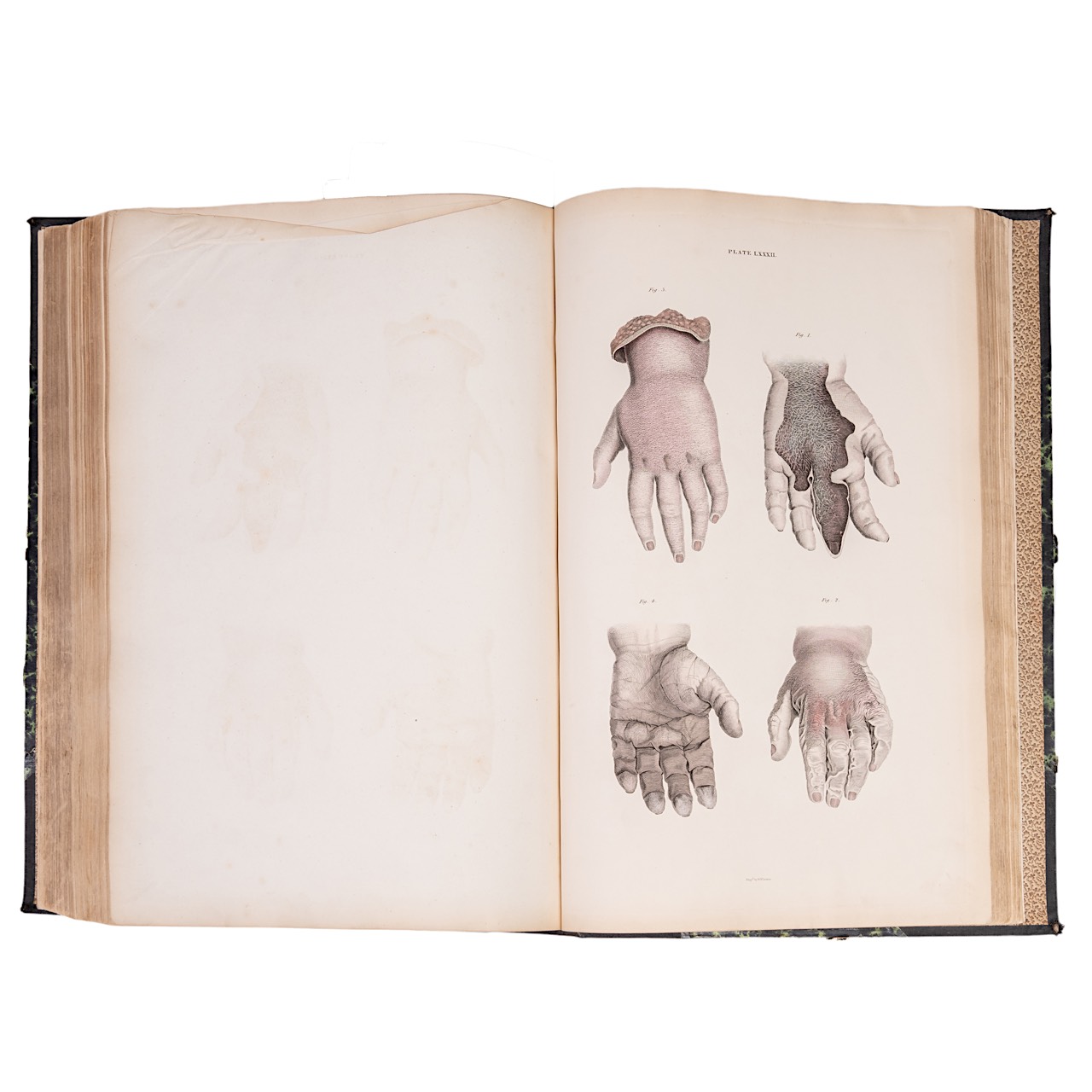 John Lizars (ca. 1792-1860), a System of Anatomical Plates of the Human Body. Edinburgh: W.H. Lizars - Bild 7 aus 7