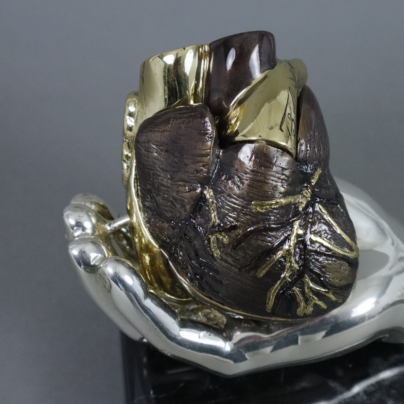 Klotz, Prof. (Dr. med.) Theodor - "Heart in Doctor's Hand“, Bronze, mehrteilig, zum Teil versilbert - Image 3 of 6