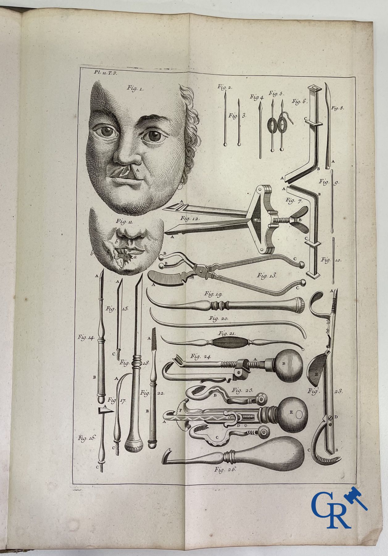 Early printed books: Dictionnaire Universel de Medecine, Robert James. 6 volumes, Paris 1746-1748. - Image 26 of 35