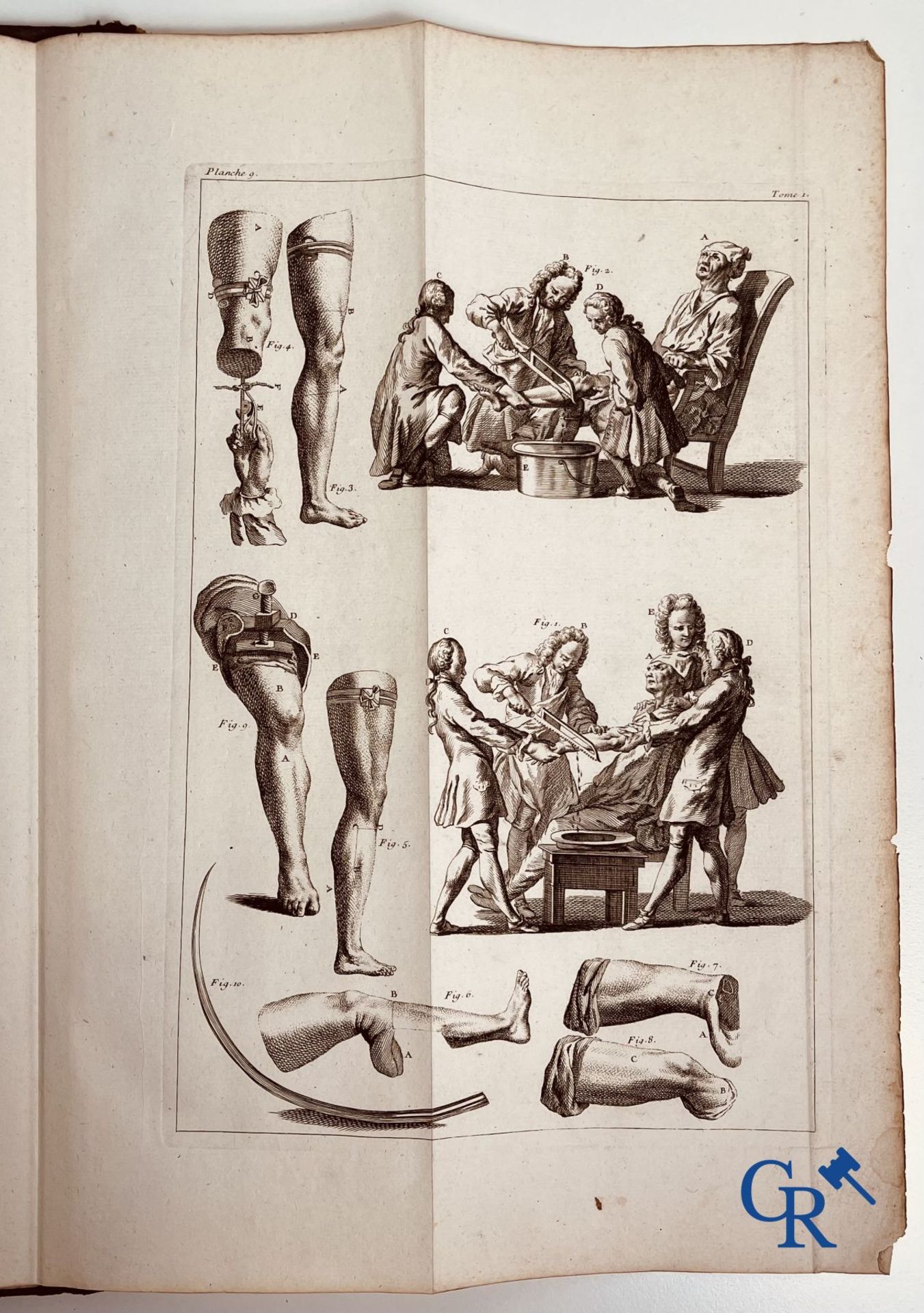 Early printed books: Dictionnaire Universel de Medecine, Robert James. 6 volumes, Paris 1746-1748. - Image 12 of 35