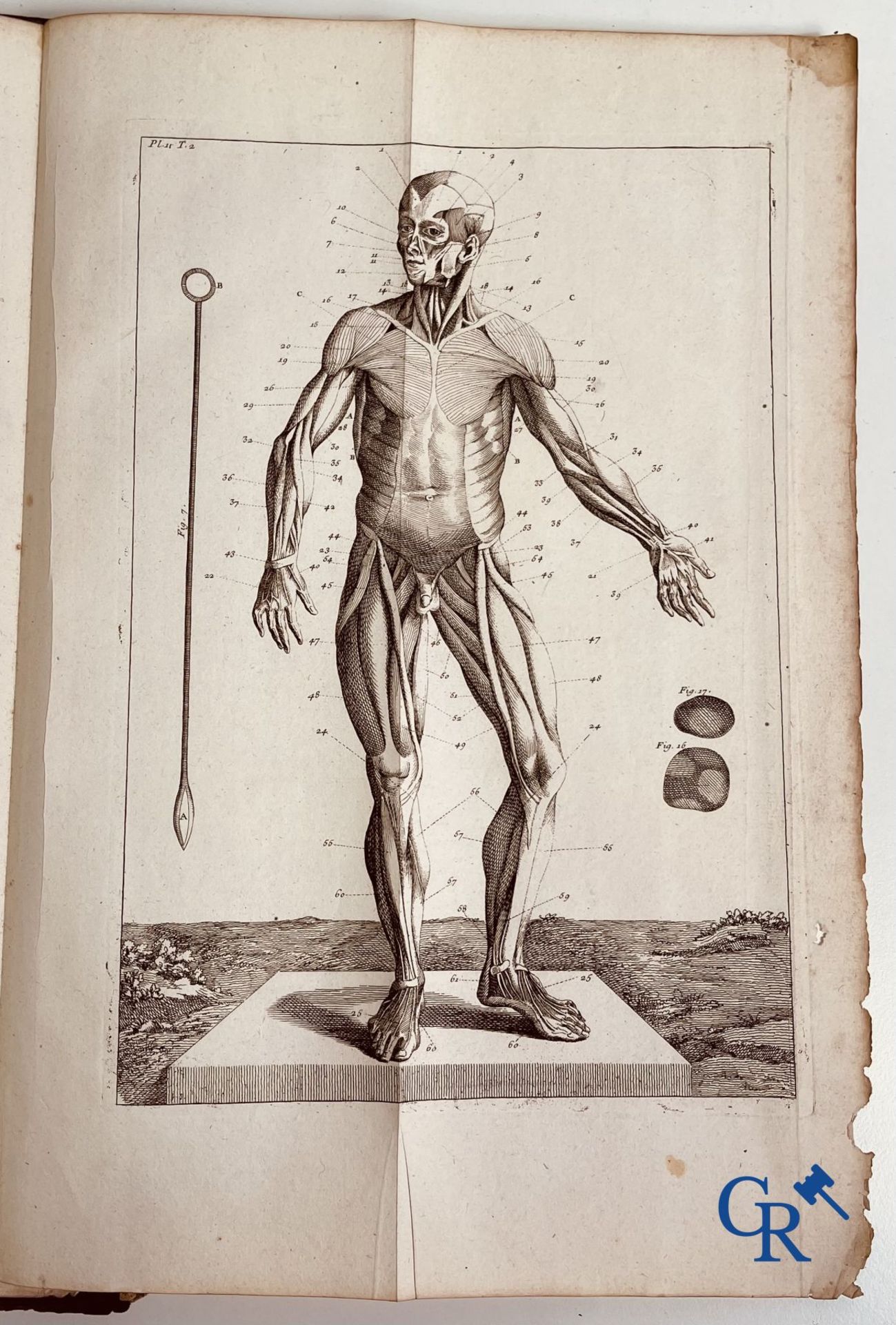 Early printed books: Dictionnaire Universel de Medecine, Robert James. 6 volumes, Paris 1746-1748. - Image 20 of 35