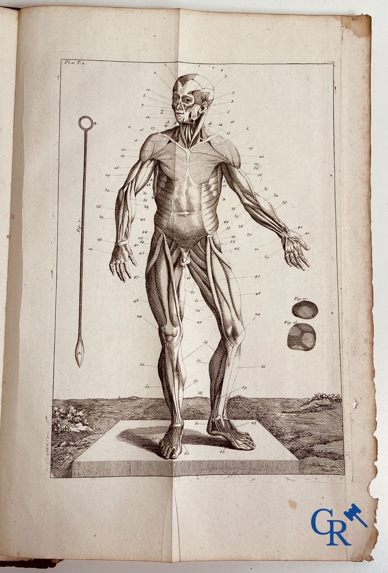 Early printed books: Dictionnaire Universel de Medecine, Robert James. 6 volumes, Paris 1746-1748. - Bild 20 aus 35