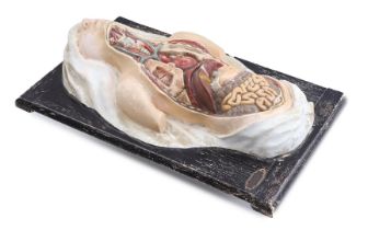 Breukhoven & Co. plaster anatomical model