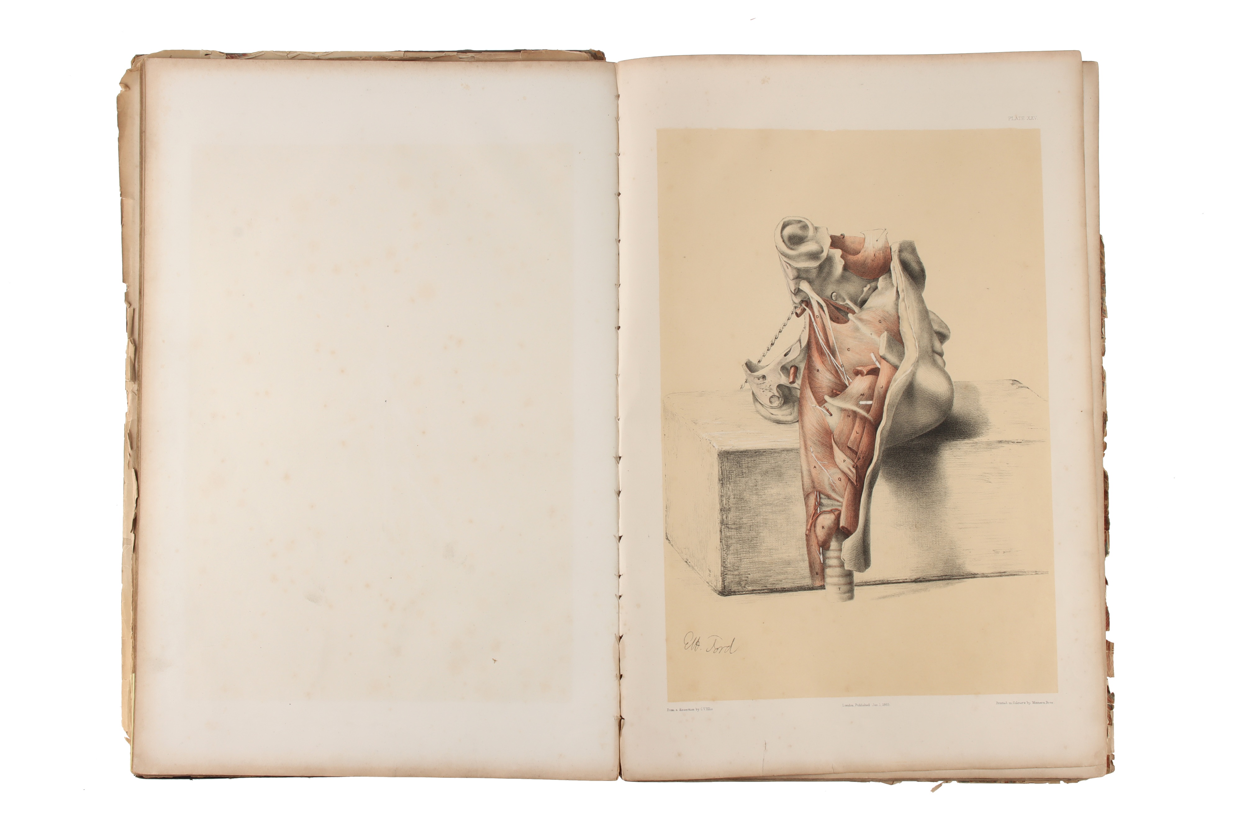 Ellis, George Viner, Illustrations of Dissections, 1867, - Image 3 of 6
