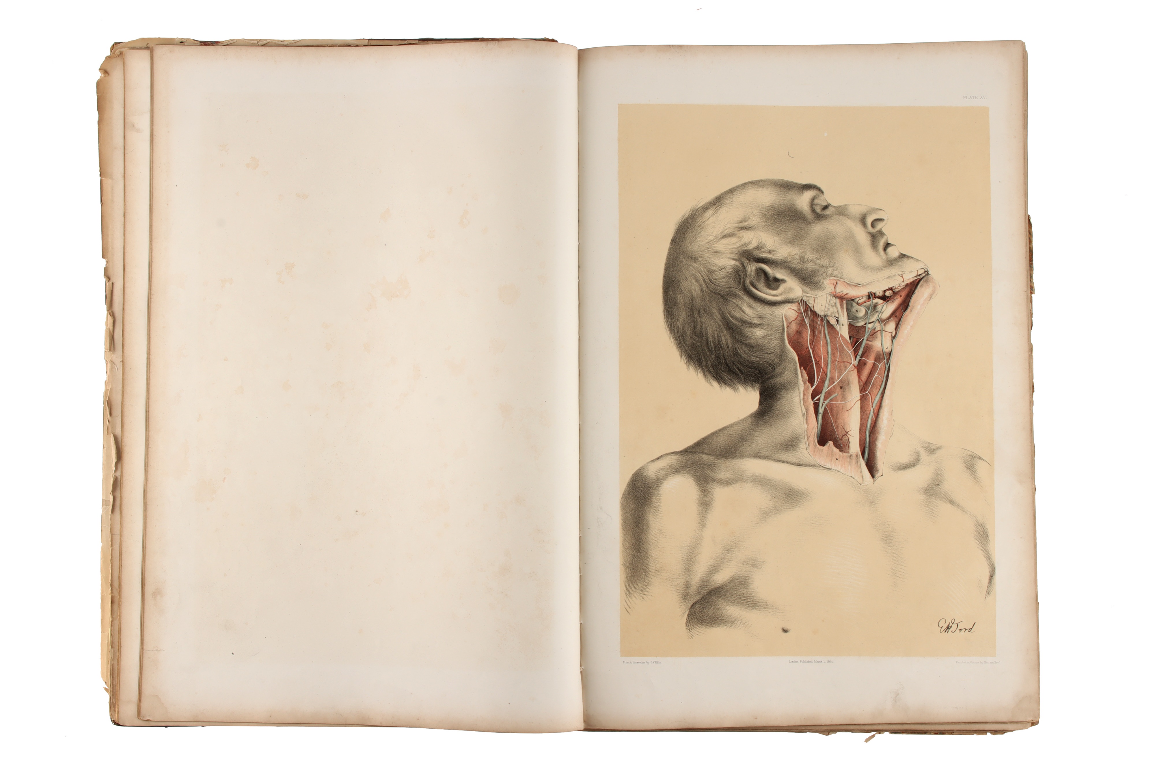 Ellis, George Viner, Illustrations of Dissections, 1867, - Image 5 of 6