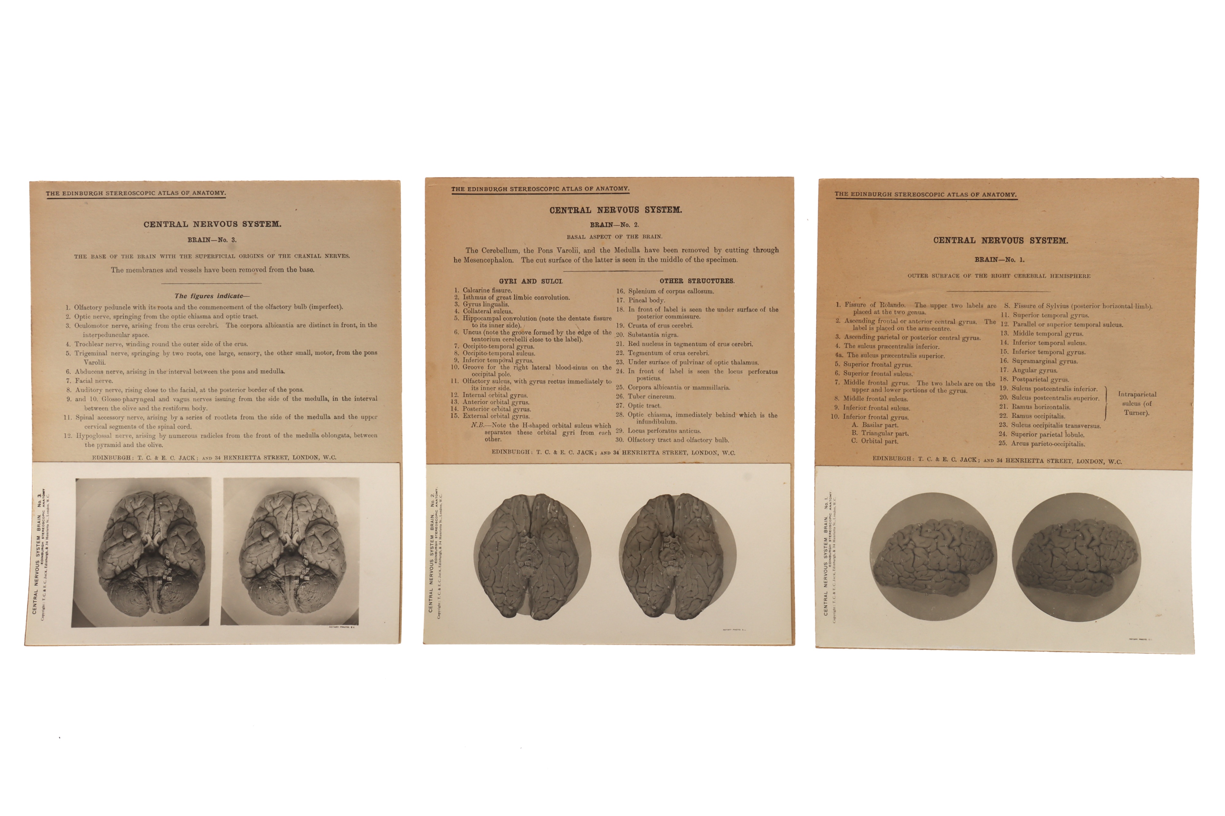 Complete Set of The Edinburgh Stereoscopic Atlas of Anatomy, - Image 2 of 2