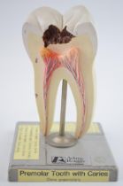 Medical / scientific 'Model of a Tooth' by Adam Rouilly, London. Made in West Germany. Height