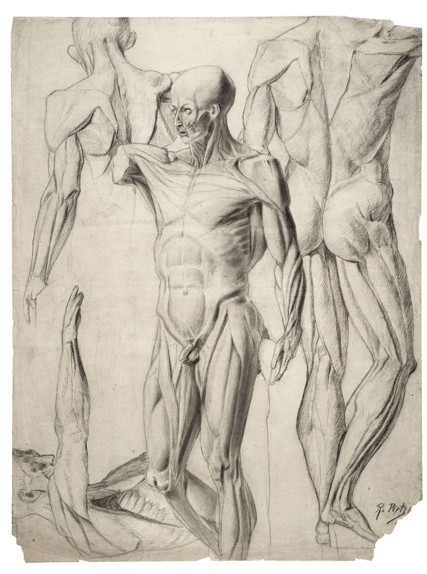 Richard Pietzsch, Vier männliche Aktstudien / Anatomische Studie. 1893.