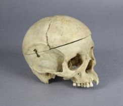 A late 19th century human skull specimen, the cranium adapted to form a casket (lacking lower jaw,