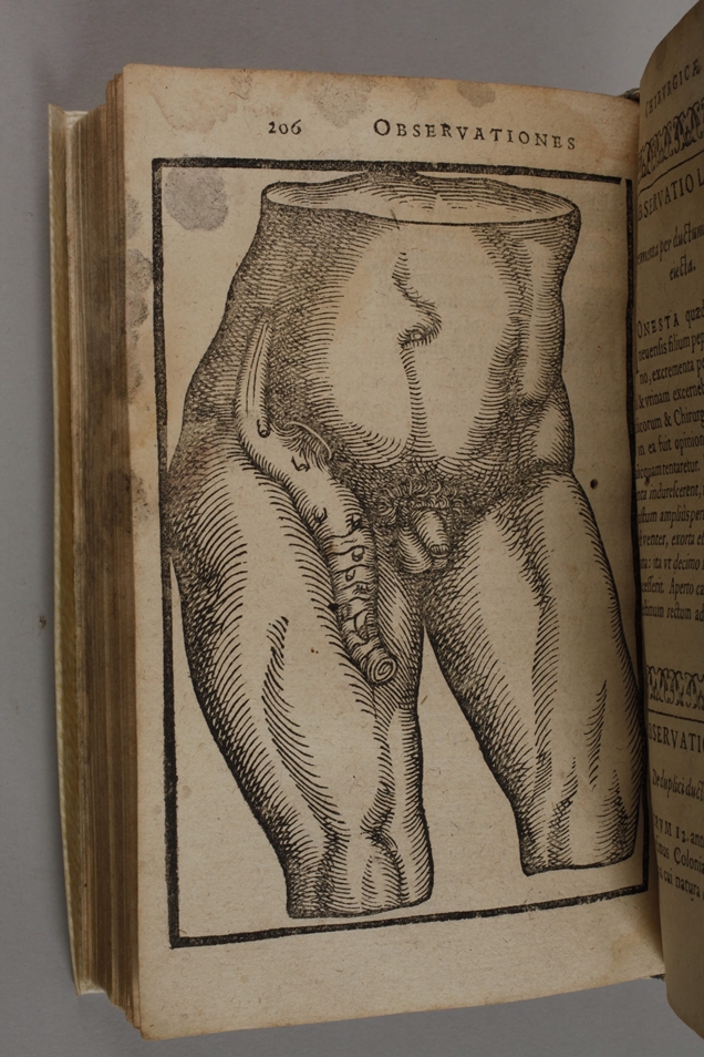 Zwei Erstausgaben Wilhelm Fabry 1606 - Bild 5 aus 6