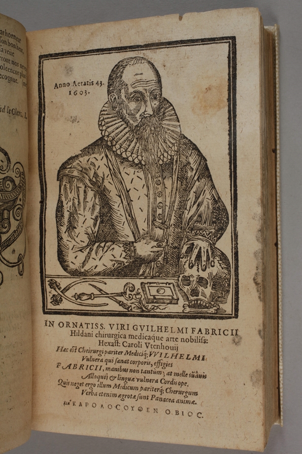 Zwei Erstausgaben Wilhelm Fabry 1606 - Bild 3 aus 6