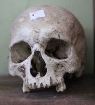 A human skull of unknown origin and age