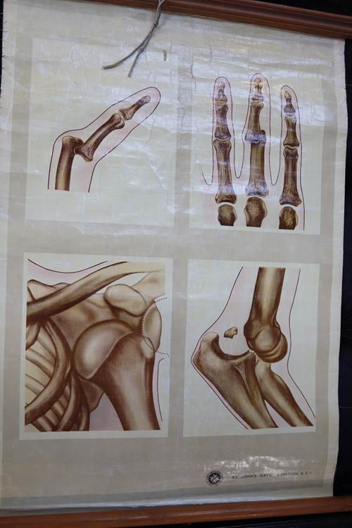 Collection of vintage medical posters (4) - Image 2 of 4