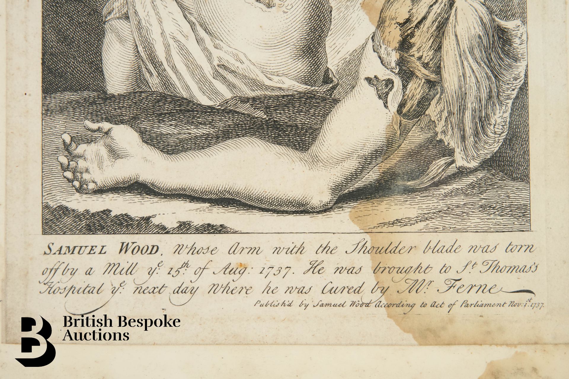 Anatomical Wood Engraving - Image 3 of 3