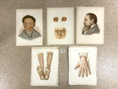 A QUANTITY OF VINTAGE A3 MEDICAL ILLUSTRATION AND PHOTOGRAPHY PLATES, FROM NEW SYDENHAM SOCIETYS