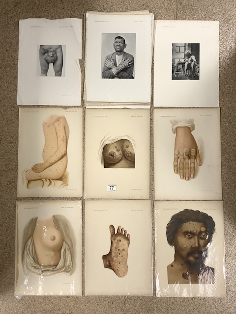 A QUANTITY OF VICTORIAN A3 MEDICAL ILLUSTRATION AND PHOTOGRAPHY PLATES, FROM NEW SYDENHAM SOCIETY'