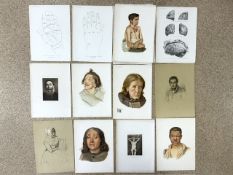 A QUANTITY OF VICTORIAN A3 MEDICAL ILLUSTRATION PLATES FROM ATLAS OF CLINICAL MEDICINE, DR BYROM