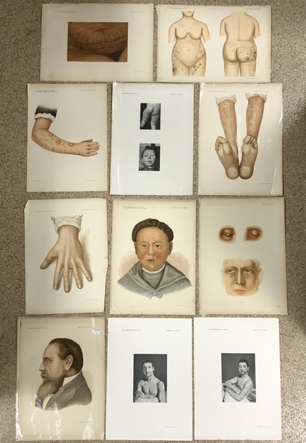 A QUANTITY OF VICTORIAN A3 MEDICAL ILLUSTRATION AND PHOTOGRAPHY PLATES, FROM NEW SYDENHAM SOCIETY' - Image 2 of 2