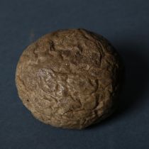 A bezoar, a stone found in the stomachs and intestines of animals and humans, this particular