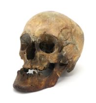 A HUMAN SKULL  The jaw detached, the whole measuring approx. 16cm in height Condition Report: