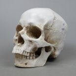 Model of a Skull